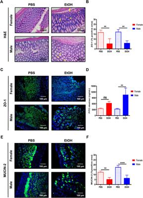 Intestinal Epithelial Cell-Derived Extracellular Vesicles Modulate Hepatic Injury via the Gut-Liver Axis During Acute Alcohol Injury